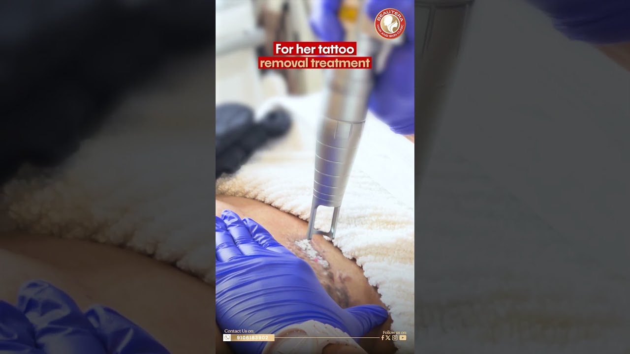 Celebrity Visit | Actress Parul Chauhan | Beautera hair and skin clinic | Tattoo removal treatment