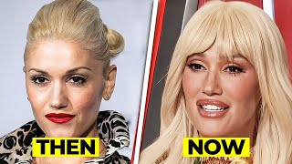 What happened to Gwen Stefani’s Face
