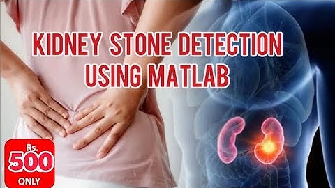 Kidney Stone Detection Using Image Processing | Kidney Stone Detection Using MATLAB