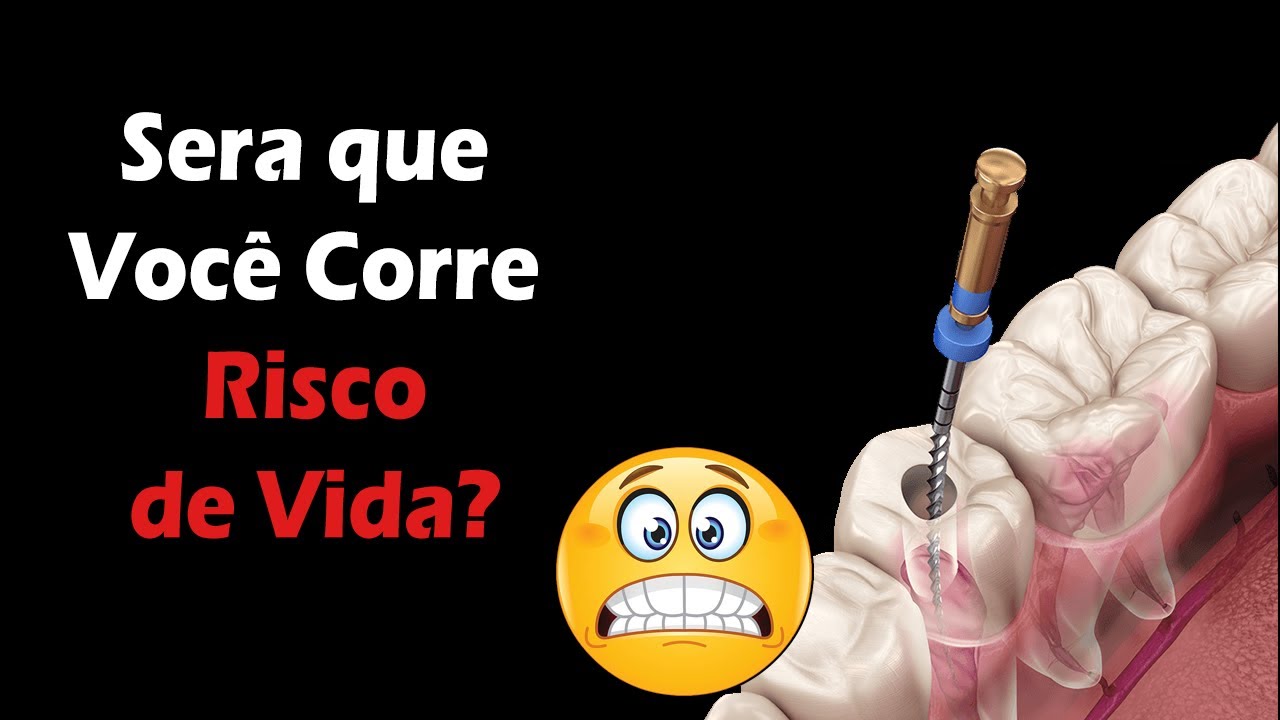 Fiz Restauração é Meu Dente Dói Quando Bebo água Gelada Canal no Dente - Descubra Quais os Riscos e o Que Acontece se Você NÃO