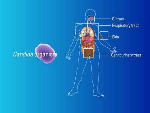 Sources of Candida Organisms