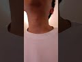 僕と自由と 森山直太朗