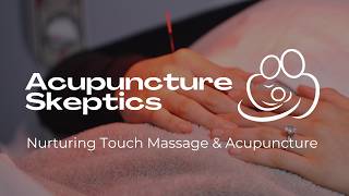 Acupuncture Skeptics