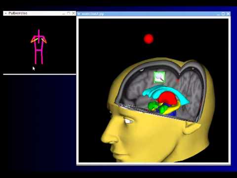brain Kinect
