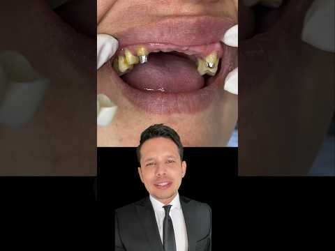 COMO HACEMOS la