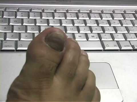 toe nail rip off video