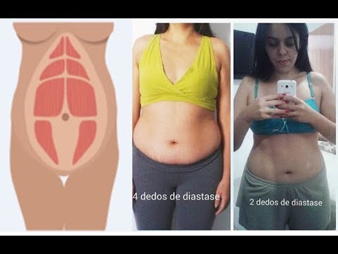 dieta para perder barriga apos gravidez