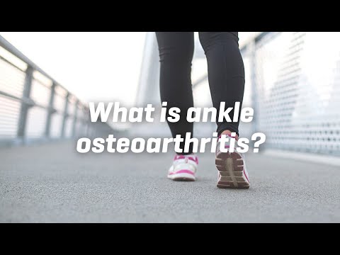 टखने का ऑस्टियोआर्थराइटिस क्या है?