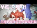 早産(22週5日 4ヶ月早く)生まれた娘の成長 〜妊娠・入院・出産・生後100日までの記録〜 (Newborn baby premature)