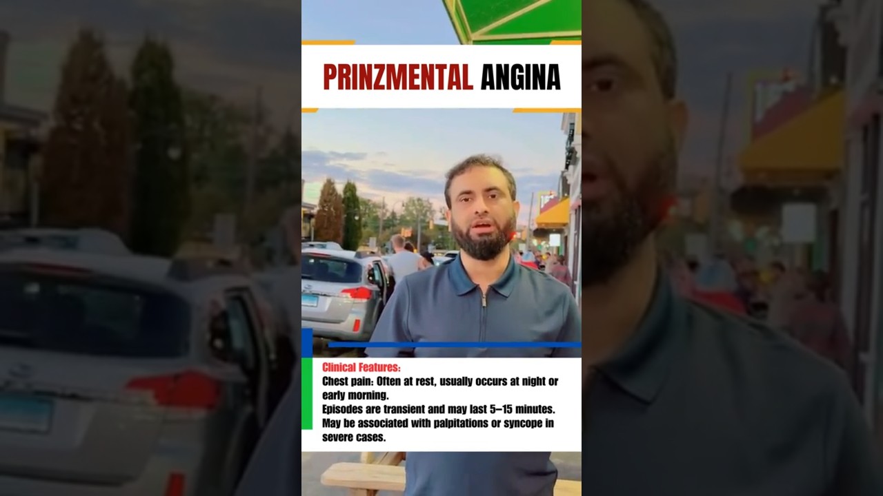 Prinzmetal Angina | Exam Key Points | Dr Hafiz Atif | AMC, NRE, USMLE-2CK, JCAT, FCPS, SLE, DHA