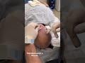 Пересадка волос/ Пересадка волос в Москве / Пересадка волос сколько / Анестезия