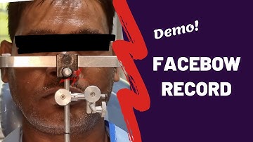 Facebow Record & its Transfer | Clinical DEMO
