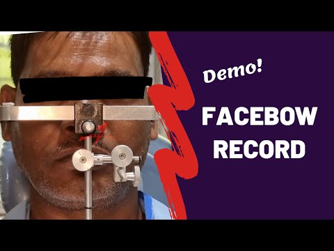 Video: Wat neemt een facebow op?