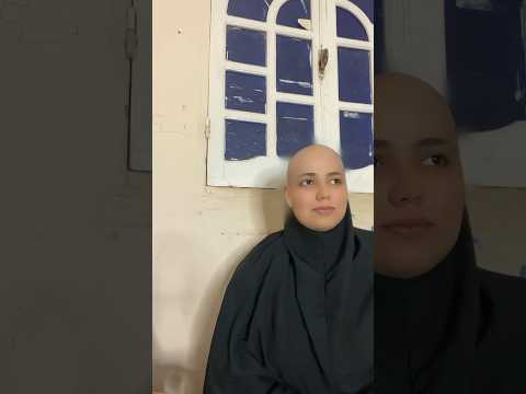 عينها المدوره الحسوده خليتها قرعه  