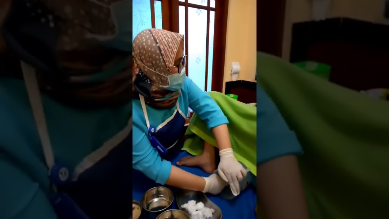 Penatalaksanaan Persalinan Sungsang