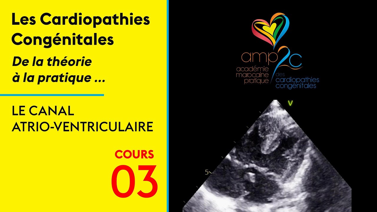 Cours AMP2C, Le Canal Atrio-ventriculaire (CAV)