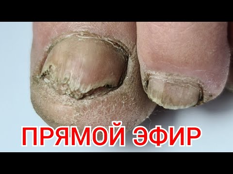 ПЕРЕВОПЛОЩЕНИЕ ПЕДИКЮР ОНЛАЙН  Виктория Авдеева