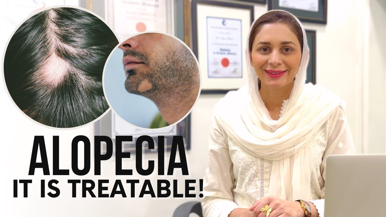 Alopecia Areata Unveiling Causes And Effective Treatments YouTube Alopecia Areata Unveiling Causes And Effective Treatments YouTube