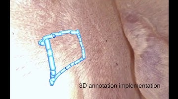 Depth Estimation for Real-time 3D Annotation in Transnasal Surgery
