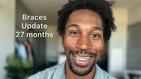 27 Month Braces Update Exciting News #braces