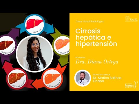 Cirrosis hepática e hipertensión portal. Dra. Diana Ortega