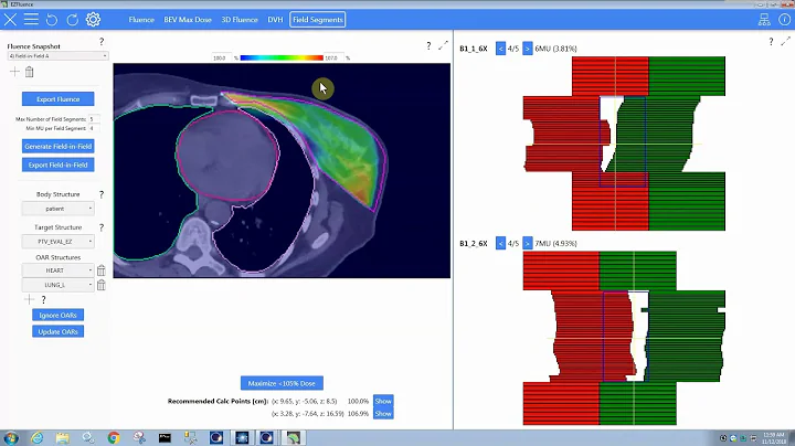 EZFluence Standard Workflow