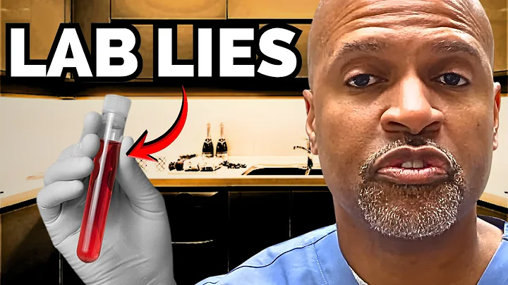 You Didn't UNDERSTAND Your CHOLESTEROL LABS Until Now