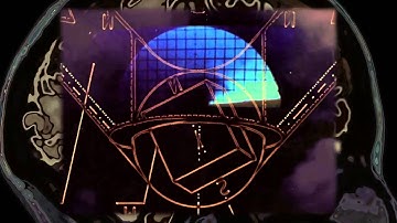 Perplex On - The Travis Walton Experience I (Official Video)