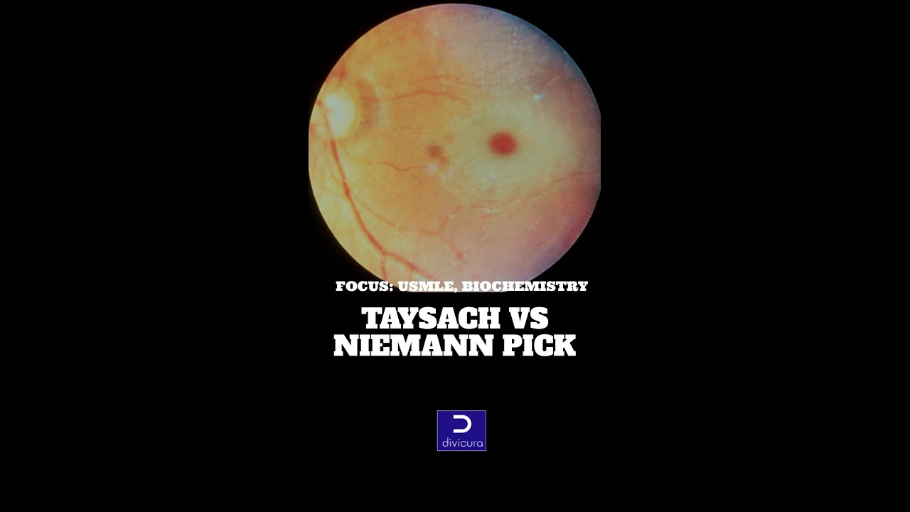 DiviCura's MediVideo 1: Tay Sach Disease vs Niemann Pick Disease