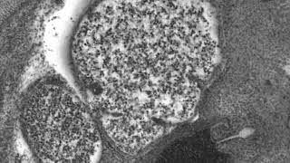 XY Scan Acquistion Mouse Embryo HREM Example