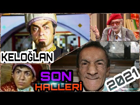 KELOĞLAN OYUNCULARI SON HALLERİ... 2021...(Öncesi ve Sonrası)