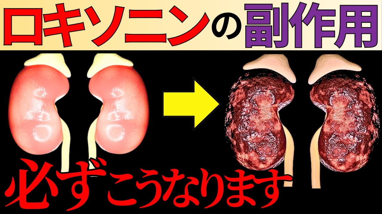 【医師監修】ロキソニンや解熱鎮痛薬を飲み続けると起こる体の6つの変化。湿布も要注意？副作用から痛みの対処法まで徹底解説