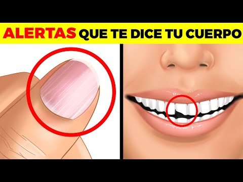 Video: ¿Puedes decir algo más seguro?