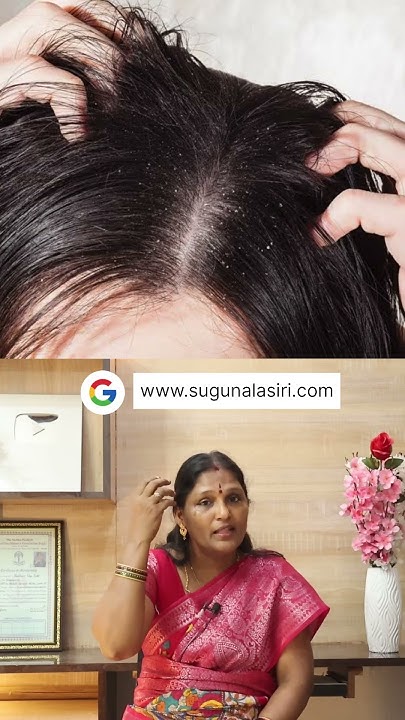 all-kind-of-hair-loss-problem-solution-youtube