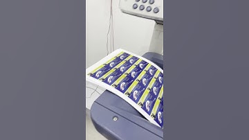 Công Ty in thẻ cào chuyên nghiệp