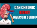How To Prevent Chronic Kidney Disease? | Dr Shoeb Ahmed Khan | Health And Beauty