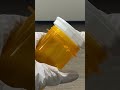 Vials thumb tab pill bottle—easy access, secure storage for pills and tablets.