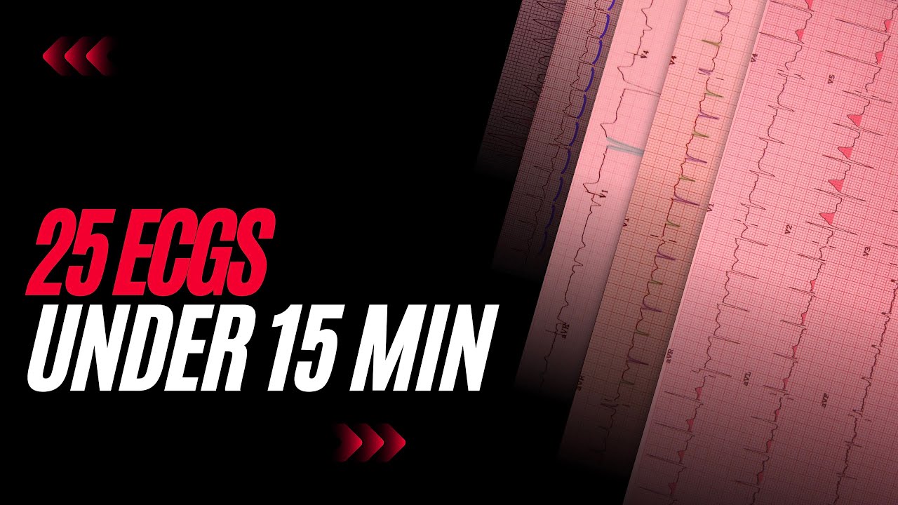 Rapid Review Of Prevention Approaches Report