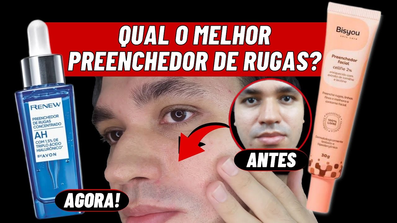 QUAL O MELHOR PREENCHEDOR DE LINHAS E RUGAS PRO ROSTO? │ TRIPLO ÁCIDO ...