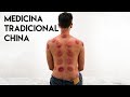 PROBANDO la VENTOSATERAPIA en CHINA (MEDICINA TRADICIONAL)