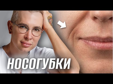 Как убрать носогубные складки? #носогубка