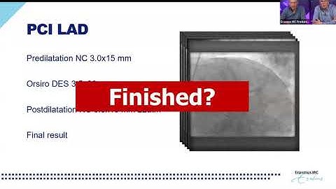 Optimizing PCI using FFR and HD IVUS - Part 1