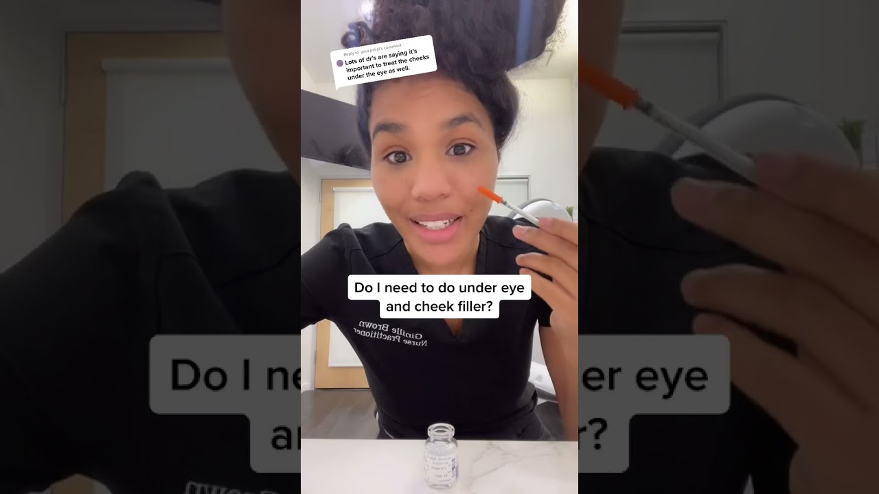 Under eye and cheek filler, tear trough injections, before and after filler, eye bags, dark circles