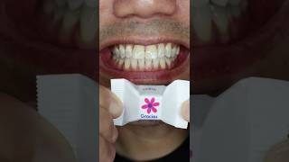 Gracias Chocolate Ritter SPORT Cubes Thank You#shorts#Doctor Tristan Peh #ASMR