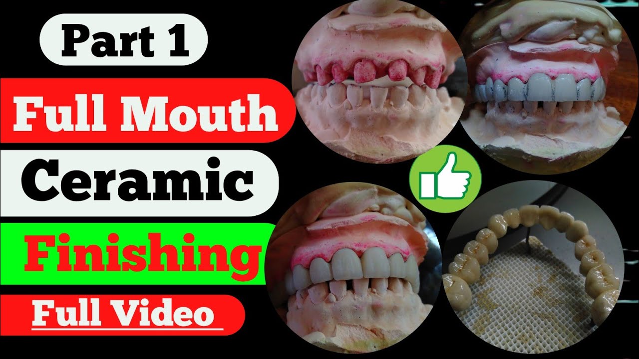 Part.1 Full Mouth Finishing Full Mouth ceramic finishing Full arch finishing Dental