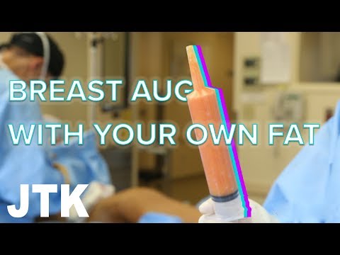 Video: Breast augmentation without surgery