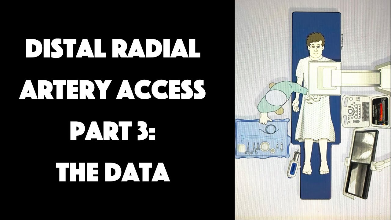 Distal Radial Artery Access Part 3: Show Me The Data - YouTube