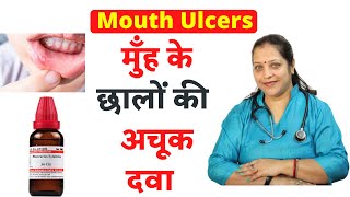 Homeopathic medicine for mouth ulcers | Homeopahtic treatment for mouth  ulcers