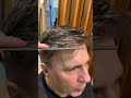 SHOCK Man Hair replacement system 🤯 PATCH CUTANEA pazzesca 💥 Protesis capilar 0086 13375586492