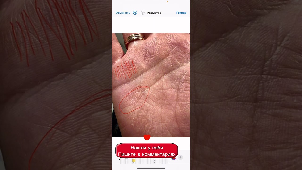 Знак целителя